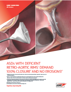 Deficient Rim GORE® CARDIOFORM ASD Occluder Product Brochure