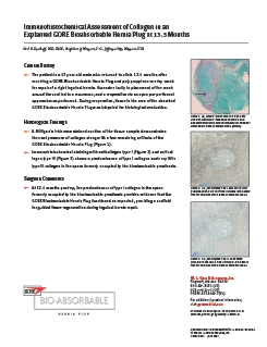Immunohistochemical Assessment of Collagen in an Explanted GORE® BIO-A® Hernia Plug at 13.5 Months